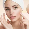 Pimples Acne