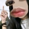 vialxa_