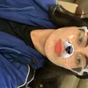 assisx_