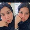 cirsaaa03