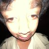 gyract1