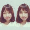 kiaa._yz