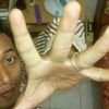 erizmpal