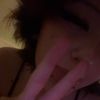 sunnburnned