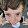 linkacha1