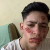 elitemre5