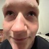 peelingflessh