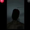 pale_abd