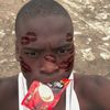 yunggold100