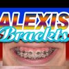 alexbrackets