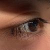 charistickdisorder