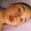 lice_careca1