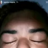 acrollyin