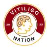 vitiligo_nation5