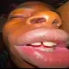 diabetes_453m