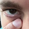 arschhaarenflechter