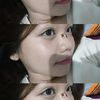 upehhh4