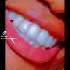 bbbinta107