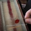 blood_slides