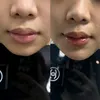 Nhật ký chữa lành