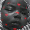 loving_rash