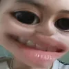 _beo_thui_02