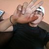 braadfer