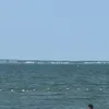 頻尿
