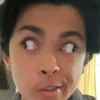 myanusisbleedinghelp