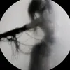 xrnd11