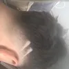 rodrigopotlood1