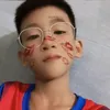 lop5gmai