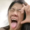zilmigz2