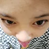 renaleneb.tinoy