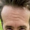 ryan_renolds_forehead