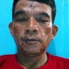 aseputom33