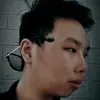 Chiếc lupus hay hát 🎤🎶