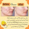 fatima.skin5