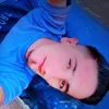 esofalazat