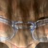 toefungus4847