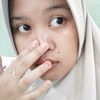 nurfa.binisdgital