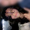 is_.anix