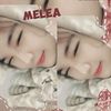 dheocha1