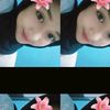 coroo_ull