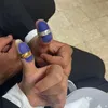 21ayo6