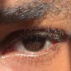 retina_altamiral