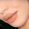 hiba6314