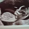 zoesjourneytomotherhood