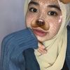 ig.mel_iy24
