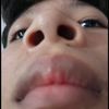 exoff_11